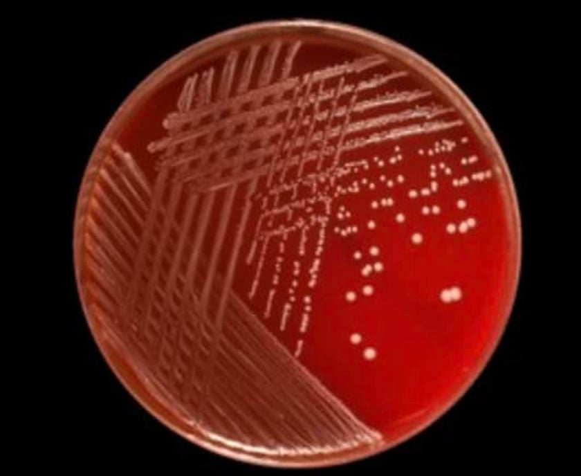Petri dish with bacteria cultures